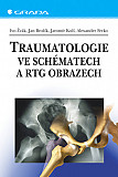 eKniha -  Traumatologie ve schématech a RTG obrazech