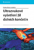 eKniha -  Ultrazvukové vyšetření žil dolních končetin