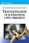 eKniha -  Traumatologie ve schématech a RTG obrazech