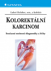 Kolorektální karcinom: Současné možnosti diagnostiky a léčby