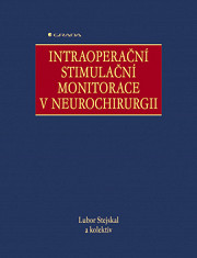 Intraoperační stimulační monitorace v neurochirurgii: 