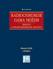 Radiochirurgie gama nožem: Principy a neurochirurgické aplikace