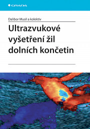 Ultrazvukové vyšetření žil dolních končetin