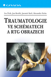 Traumatologie ve schématech a RTG obrazech