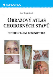 Obrazový atlas chorobných stavů: Diferenciální diagnostika