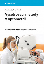 Vyšetřovací metody v optometrii: a interpretace jejich výsledků v praxi